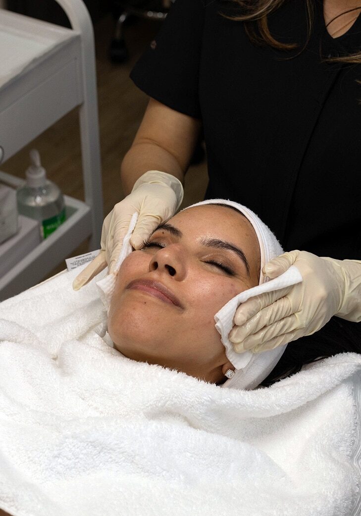Dermal-Peel-1