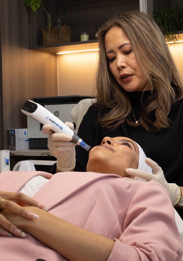Microneedling-1