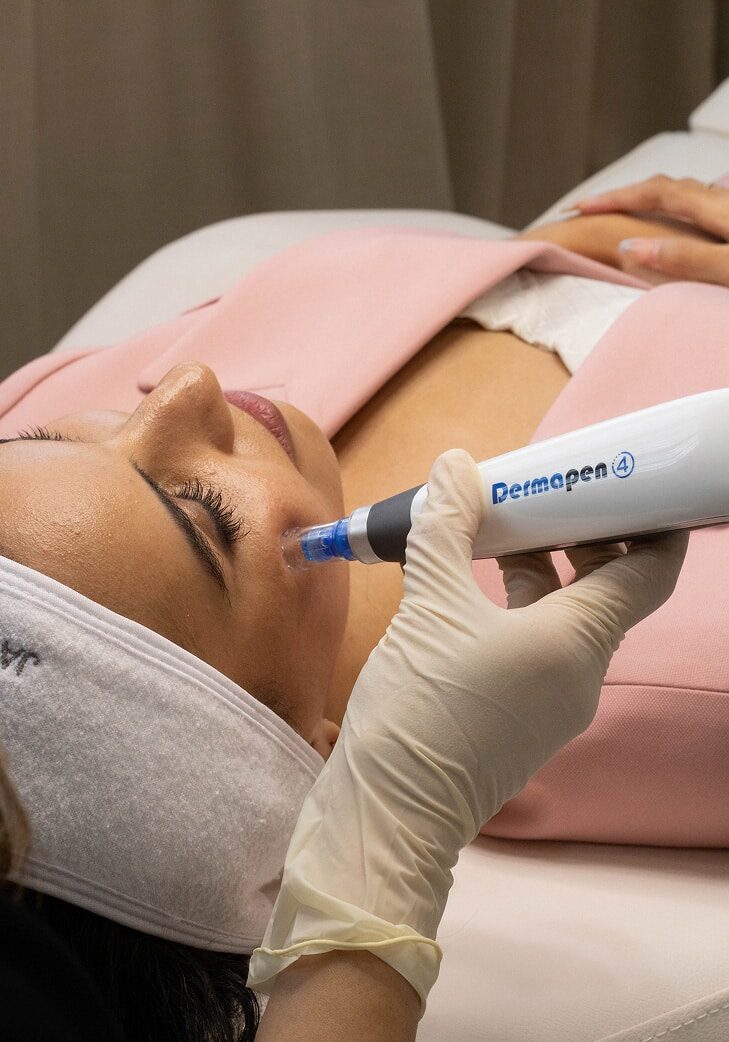 Microneedling-2